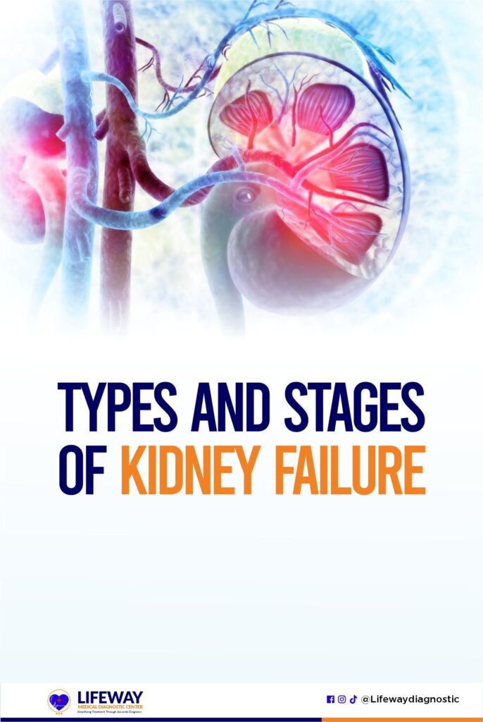 types and stages of kidney failure