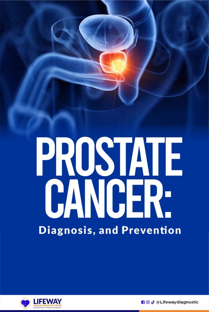 Prostate cancer: diagnosis and prevention