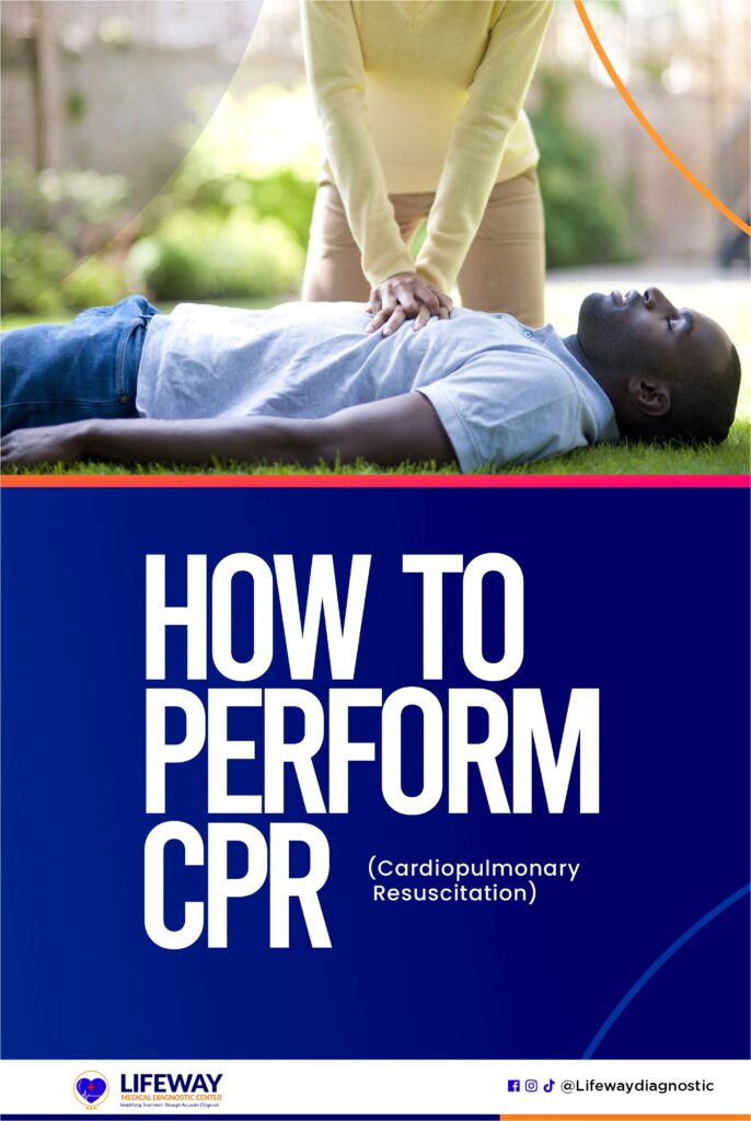 How to perform CPR