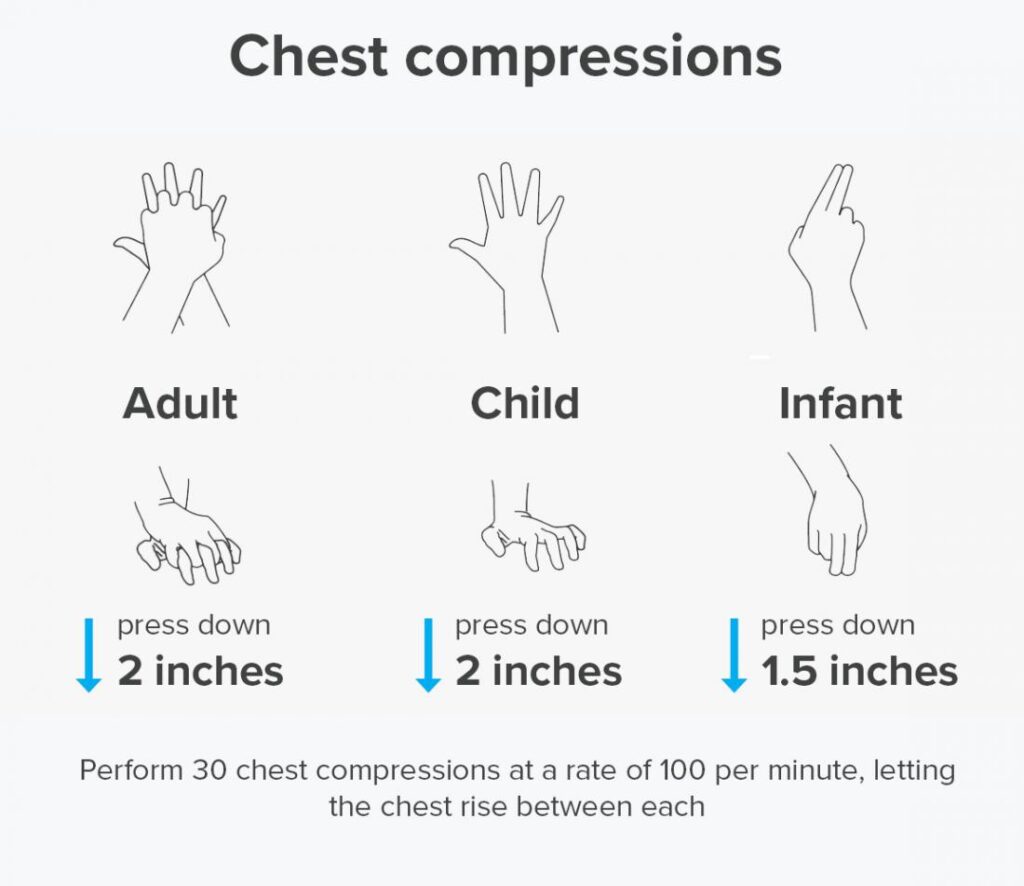 Chest compressions in CPR