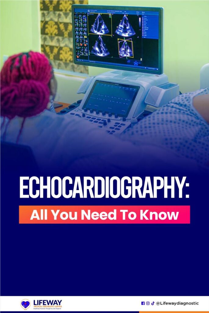 Echocardiography