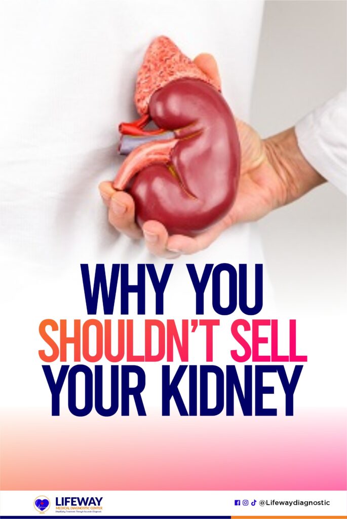 sell your kidney