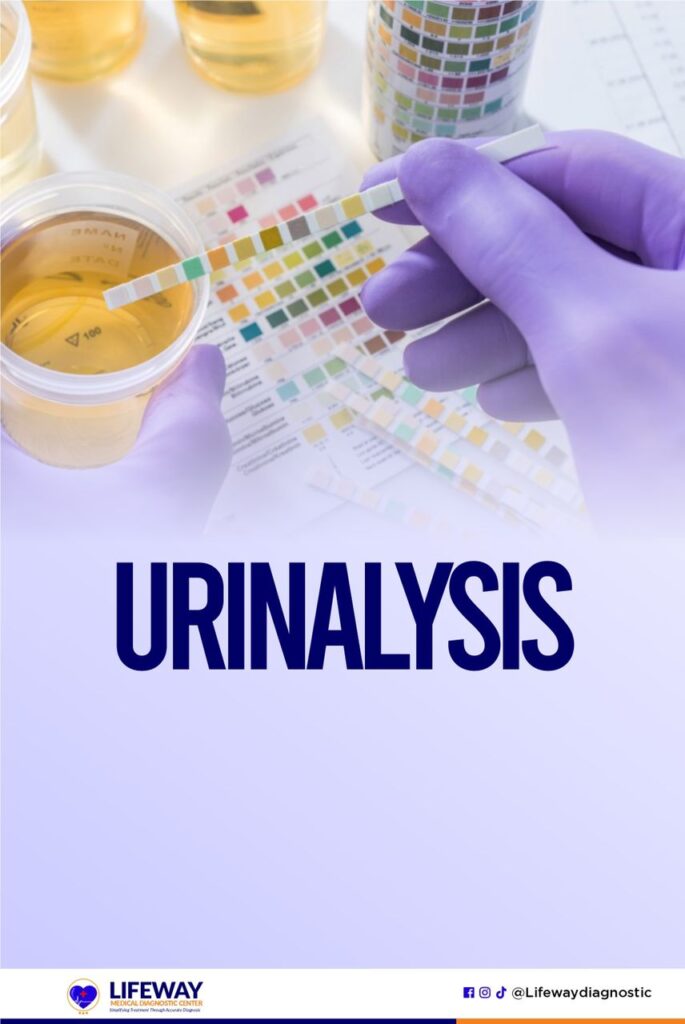 Urinalysis