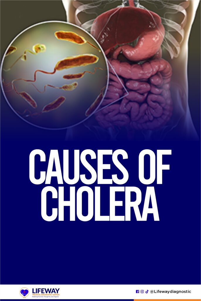 causes of cholera