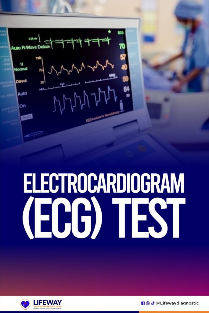 Electrocardiogram (ECG) Test