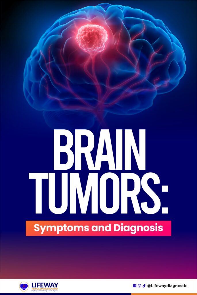 brain tumors