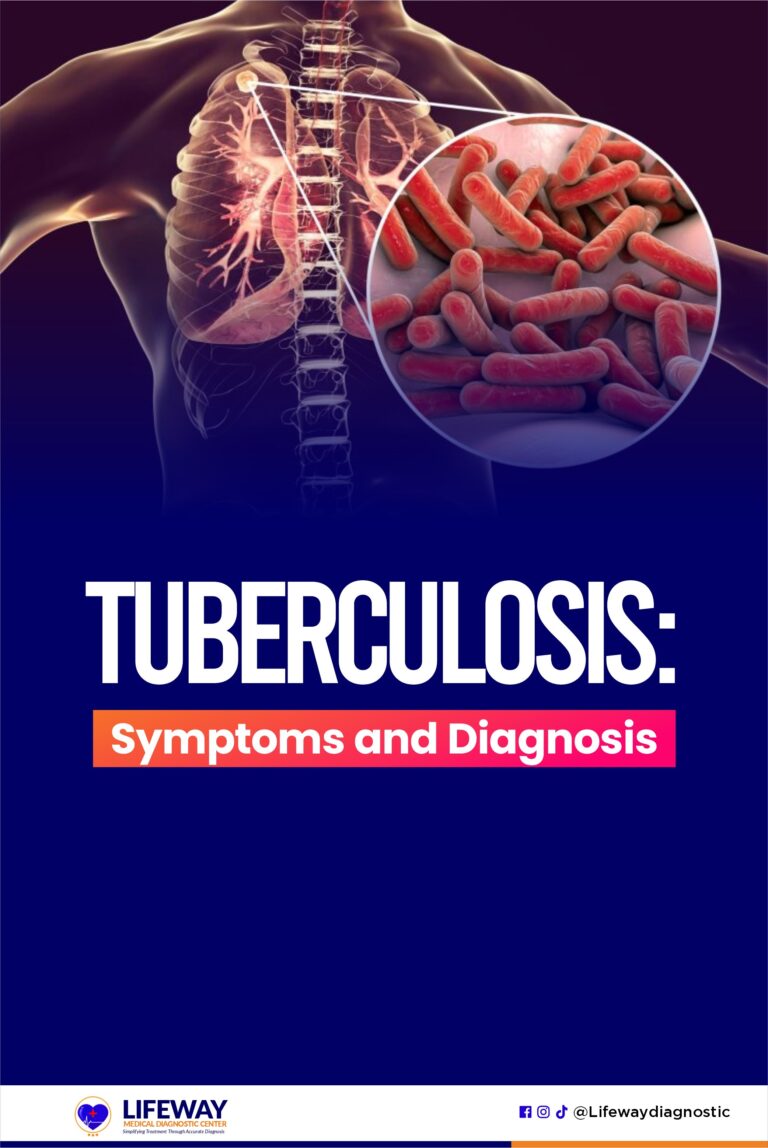 tuberculosis